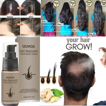 Мощный спрей-сыворотка для роста волос, Имбирь, средства для лечения выпадения волос, Восстанавливают, питают корни, волосы Быстро отрастают Мужчины Женщины  5